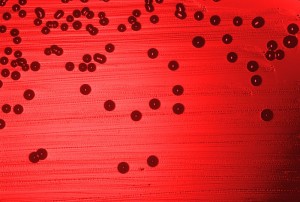 Haemophilus influenzae Haemophilus influenzae