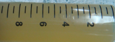 Straw coloured pericardial fluid