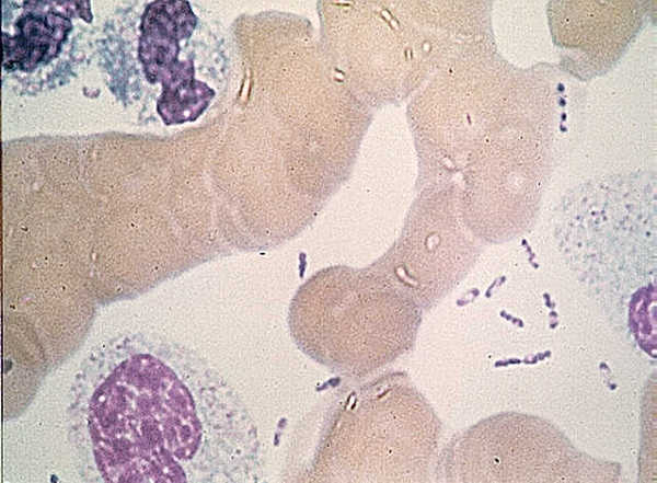 yersinia_pestis_wayson1 yersinia_pestis_wayson1