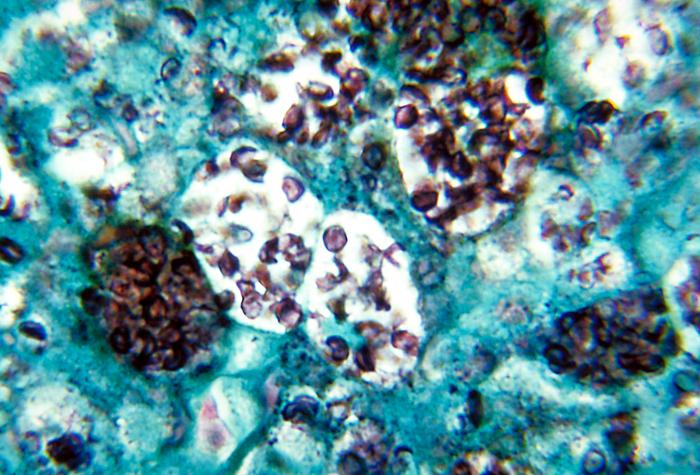 Histoplasma capsulatum Histoplasma capsulatum